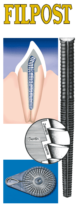 Fractal Diskimplant Structure Zahnimplantat